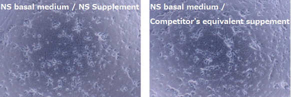 NS Basal Medium / NS Supplement
